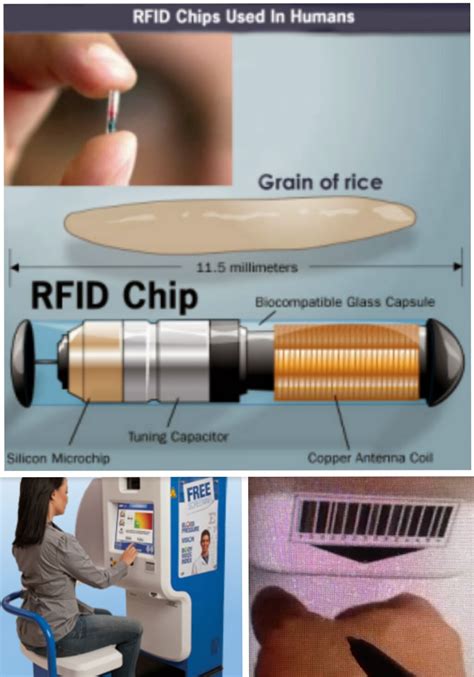 obama care law rfid chip|Will 'Obamacare' Legislation Implant U.S. Residents with .